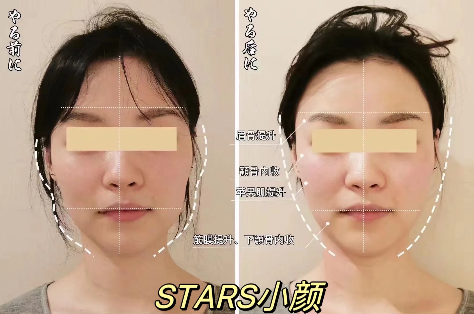 美人在皮更在骨