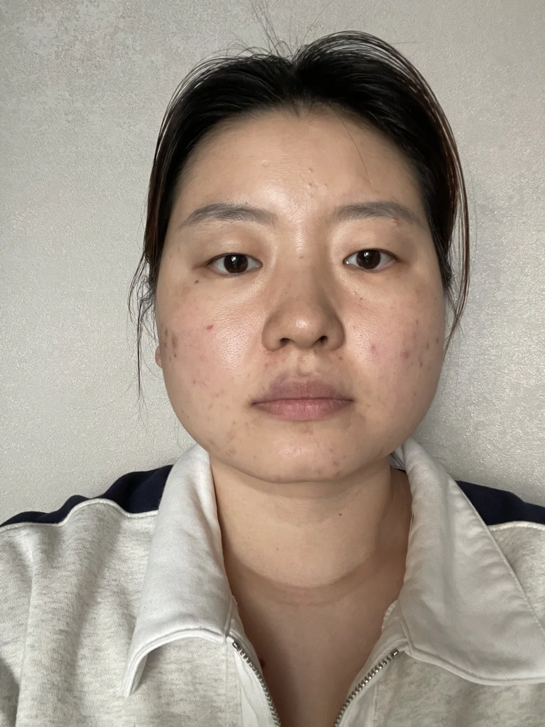 瘦20斤脸部变化
