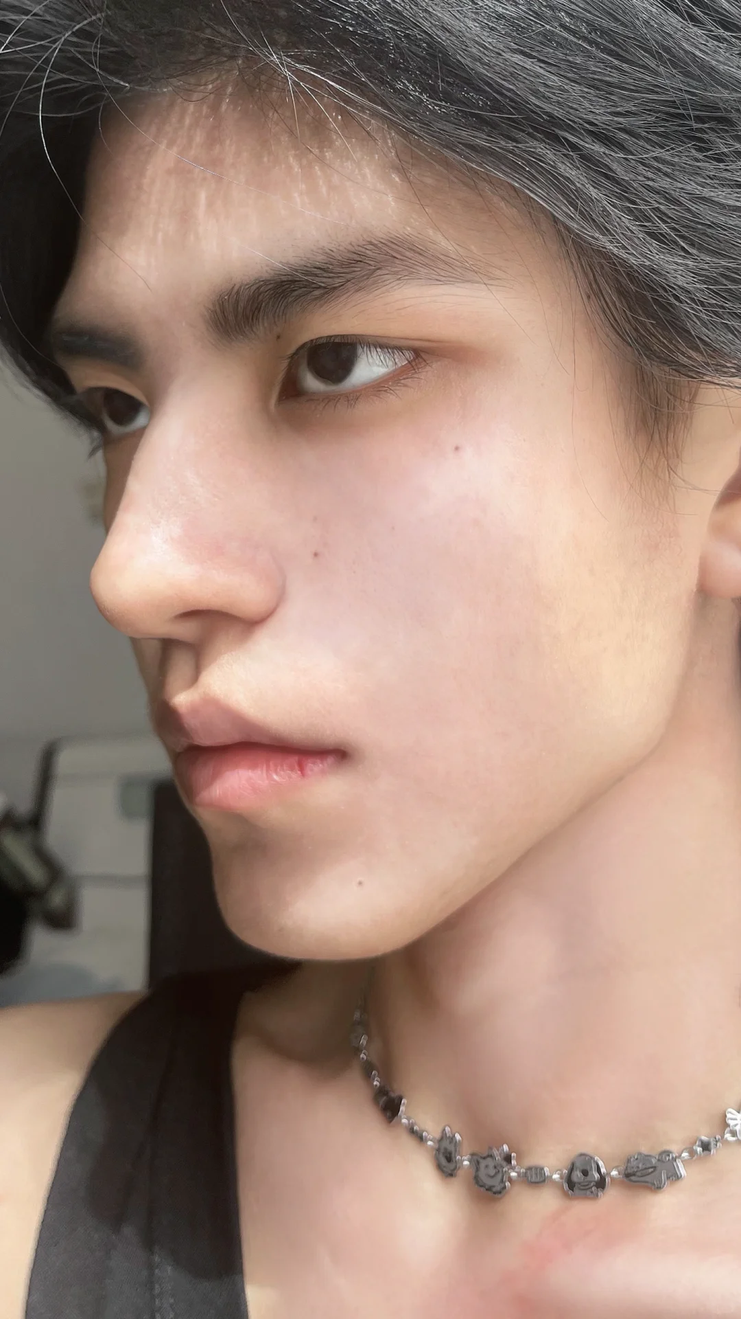 最近皮肤状态