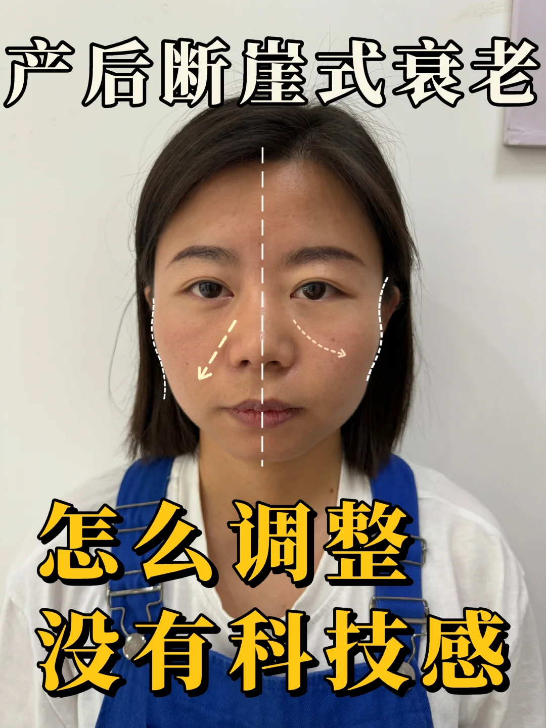 案例招募｜产后三年断崖式衰老🆘