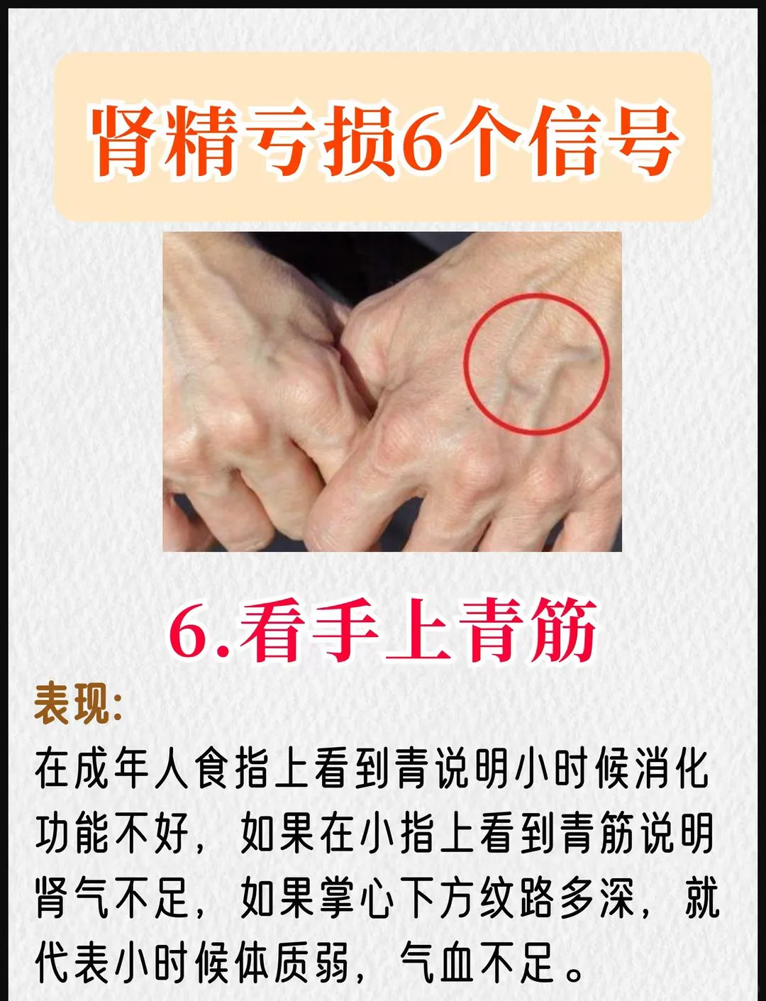 肾精亏损会出现这六个信号，看看你有没有