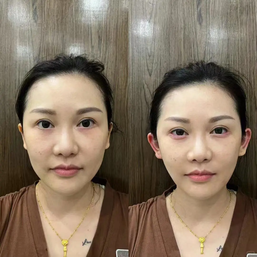 晋城首推🥰