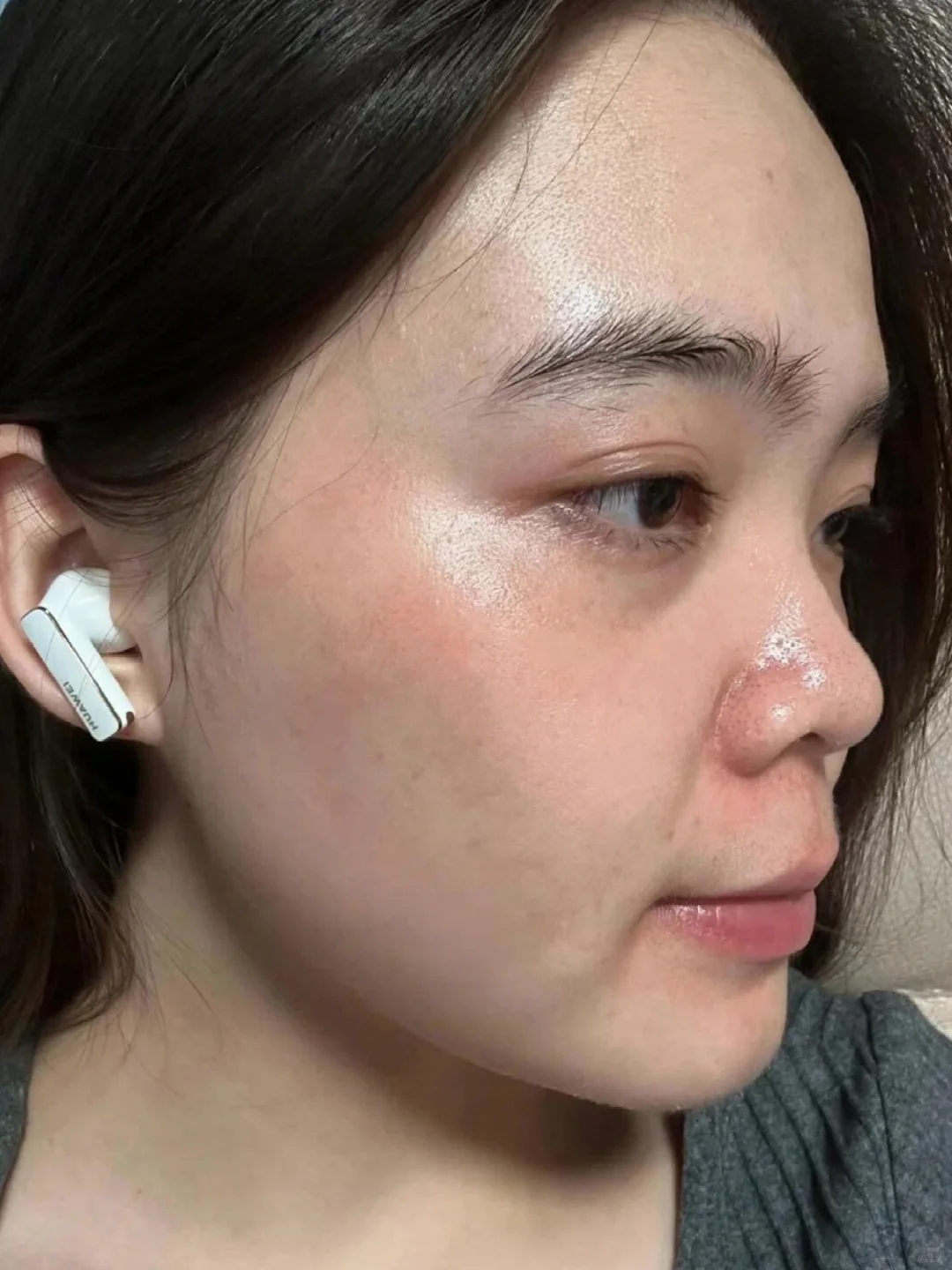 60天，跟我的满脸黄褐斑说再见了