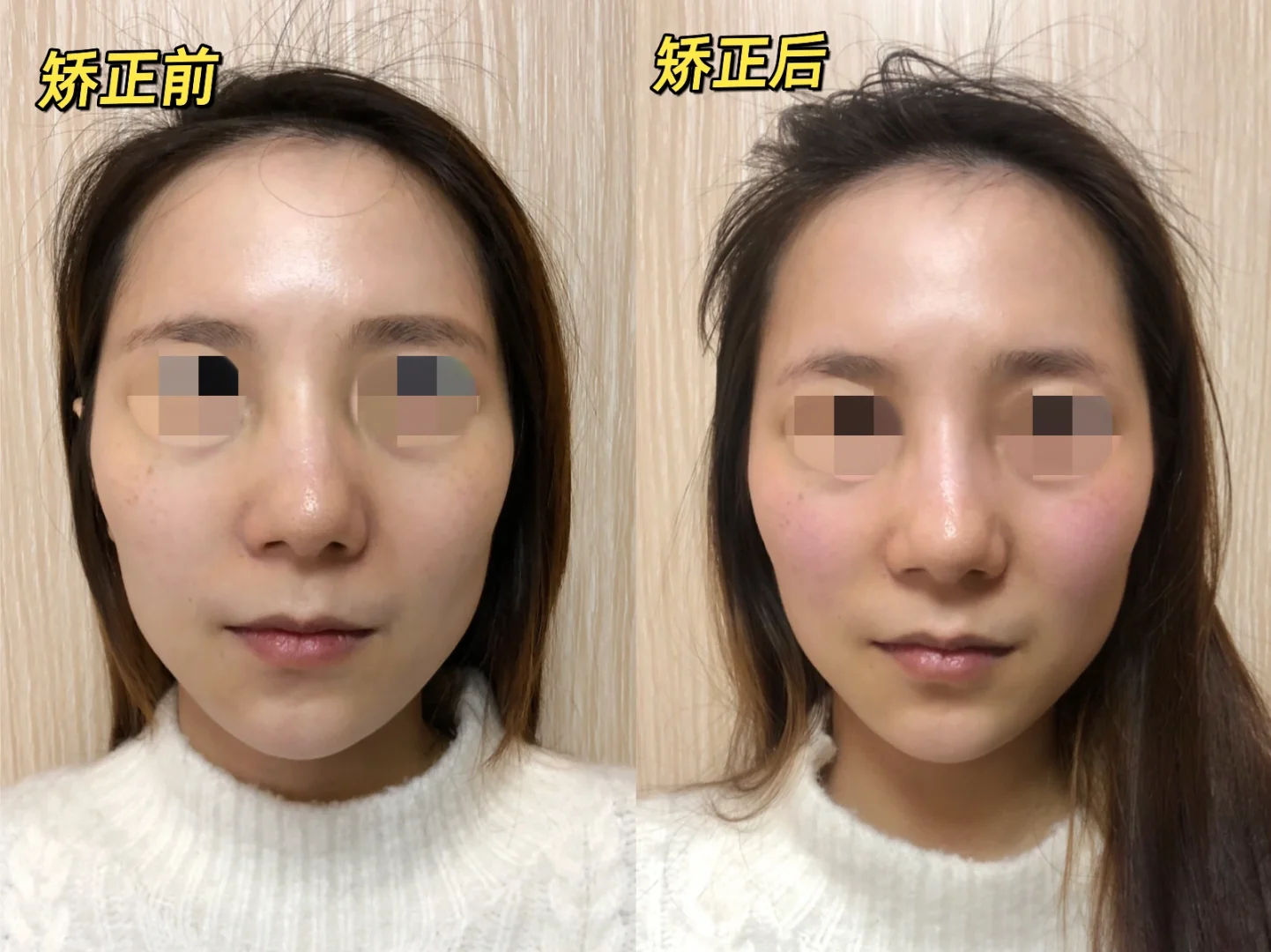 美人先美骨 .相貌的70%由骨骼决定！