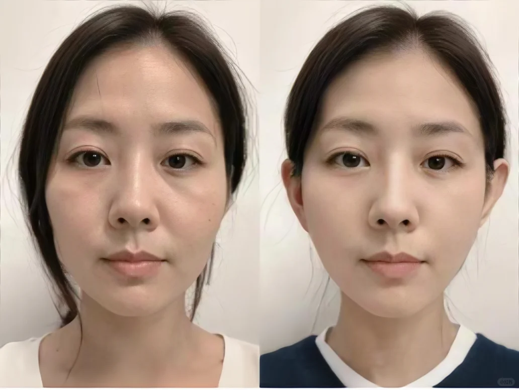 投资自己永远不亏 | 垮脸精致化微调