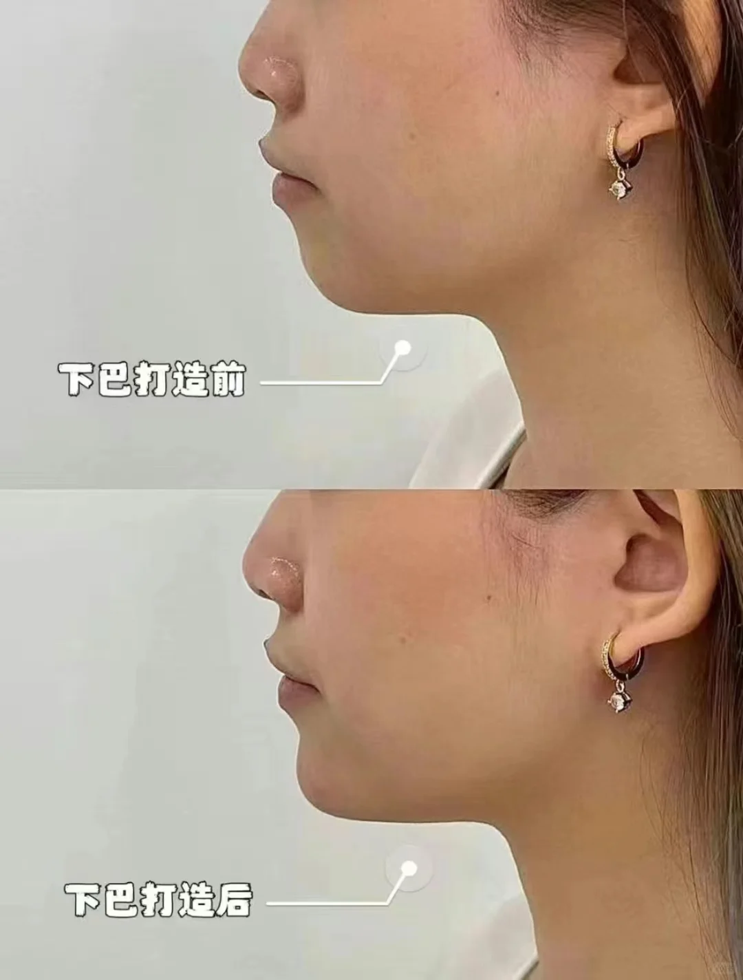 小v脸才是美女的标配