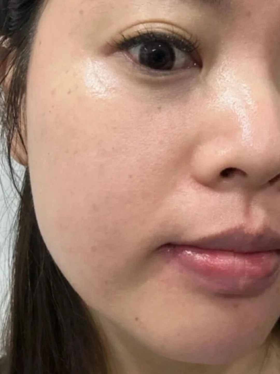 红血丝干净了