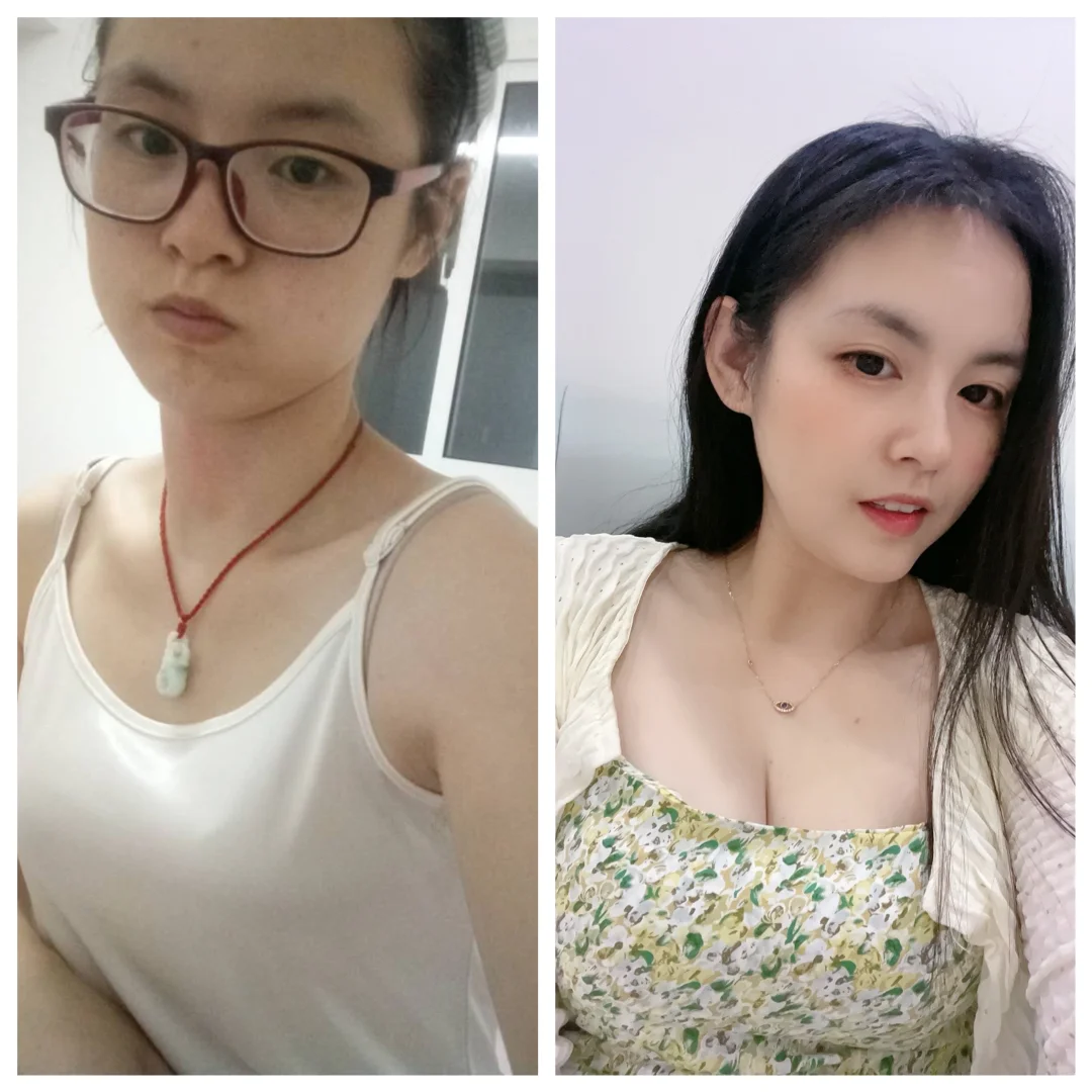 之前vs现在