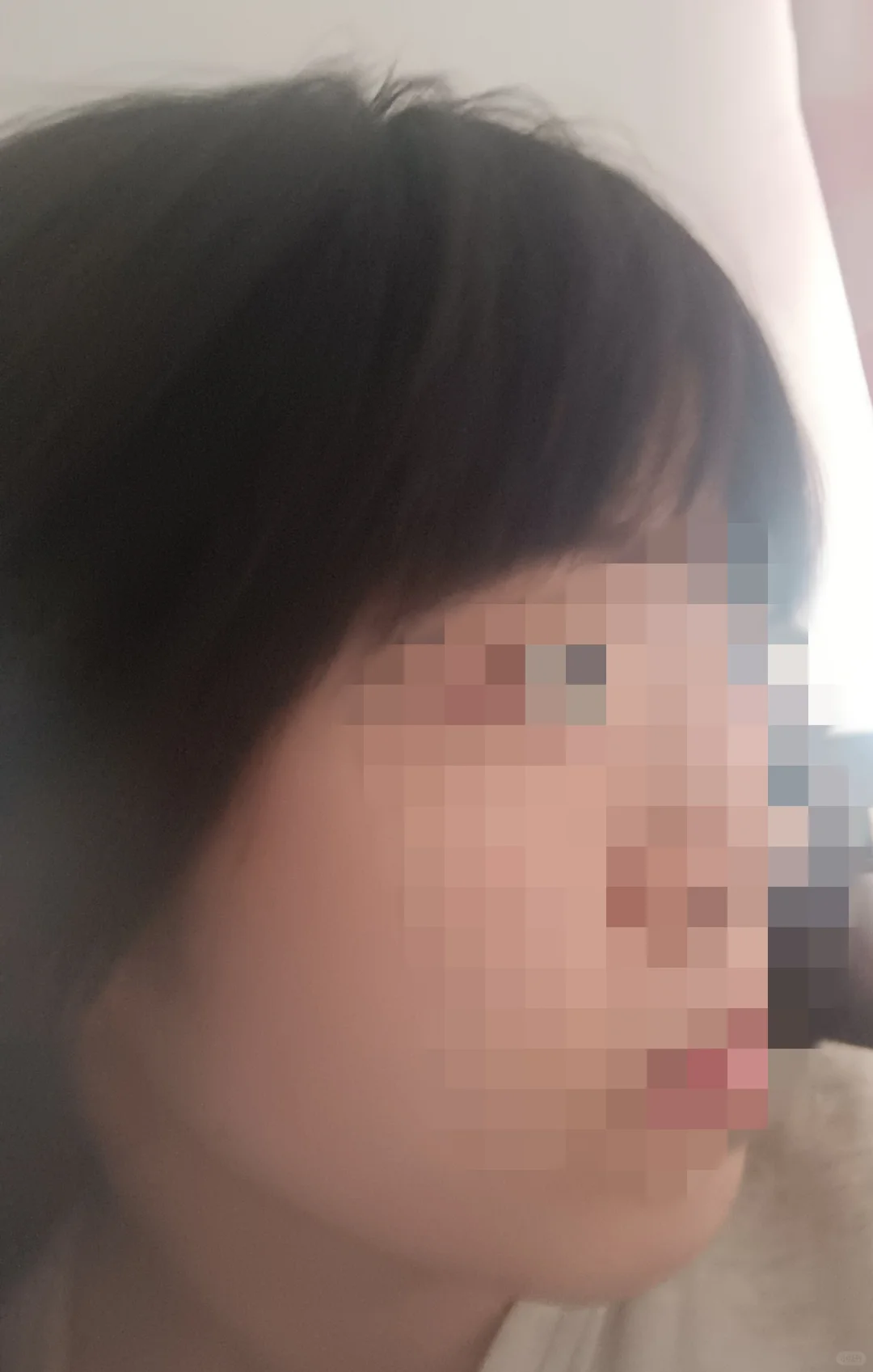 什么原因会导致脸型变化明显