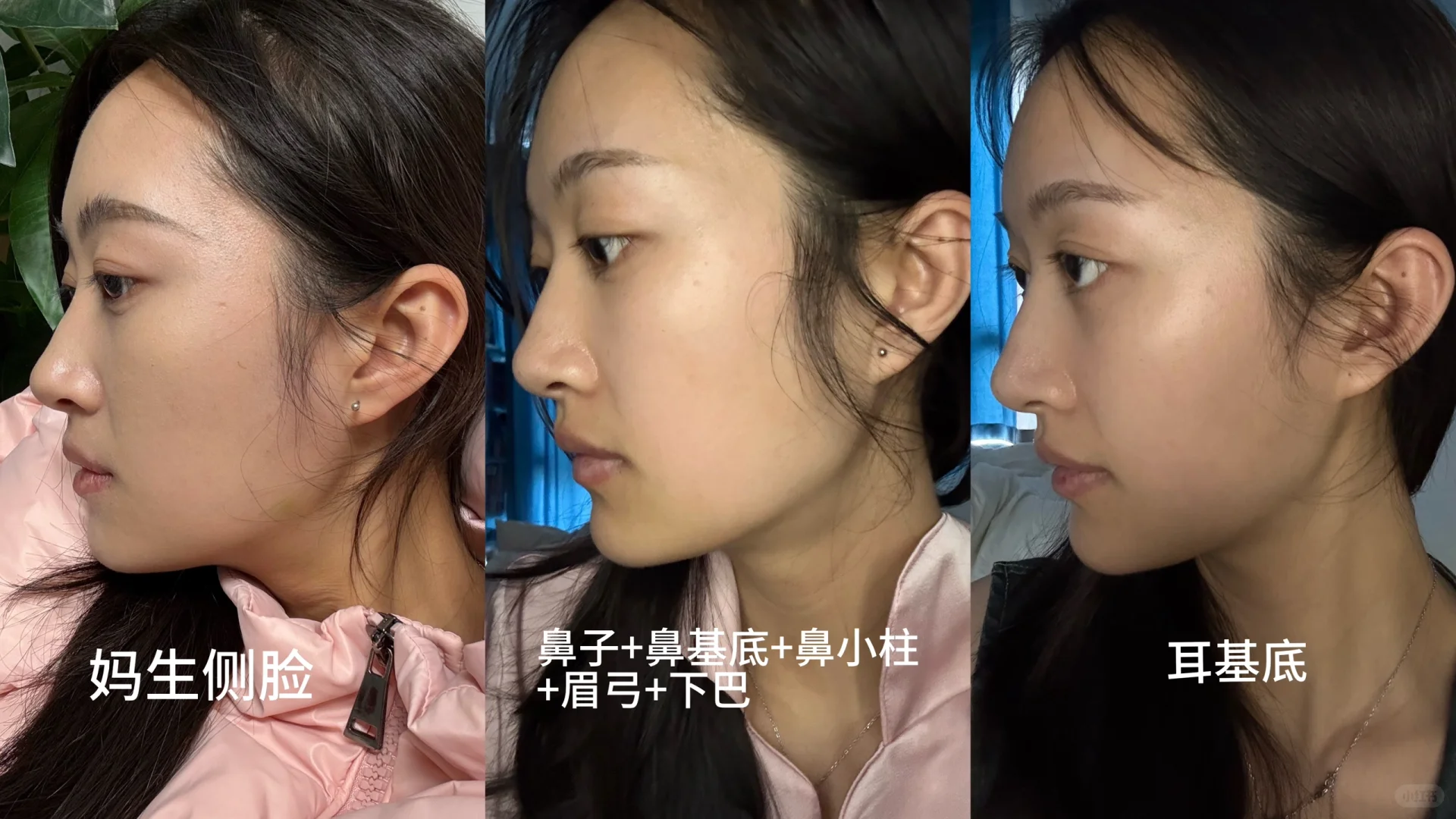 小小的脸上打了27支啵啵