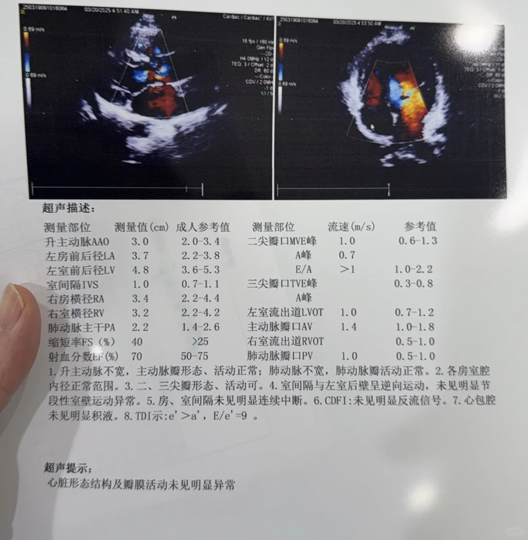 庆幸只是手指长，不是马凡综合征