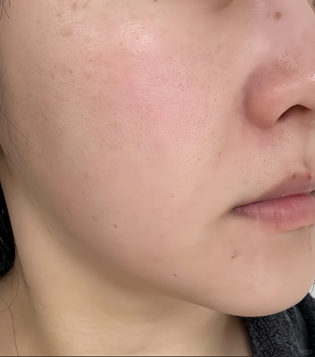 变美秘籍✨又去小韩do脸喽