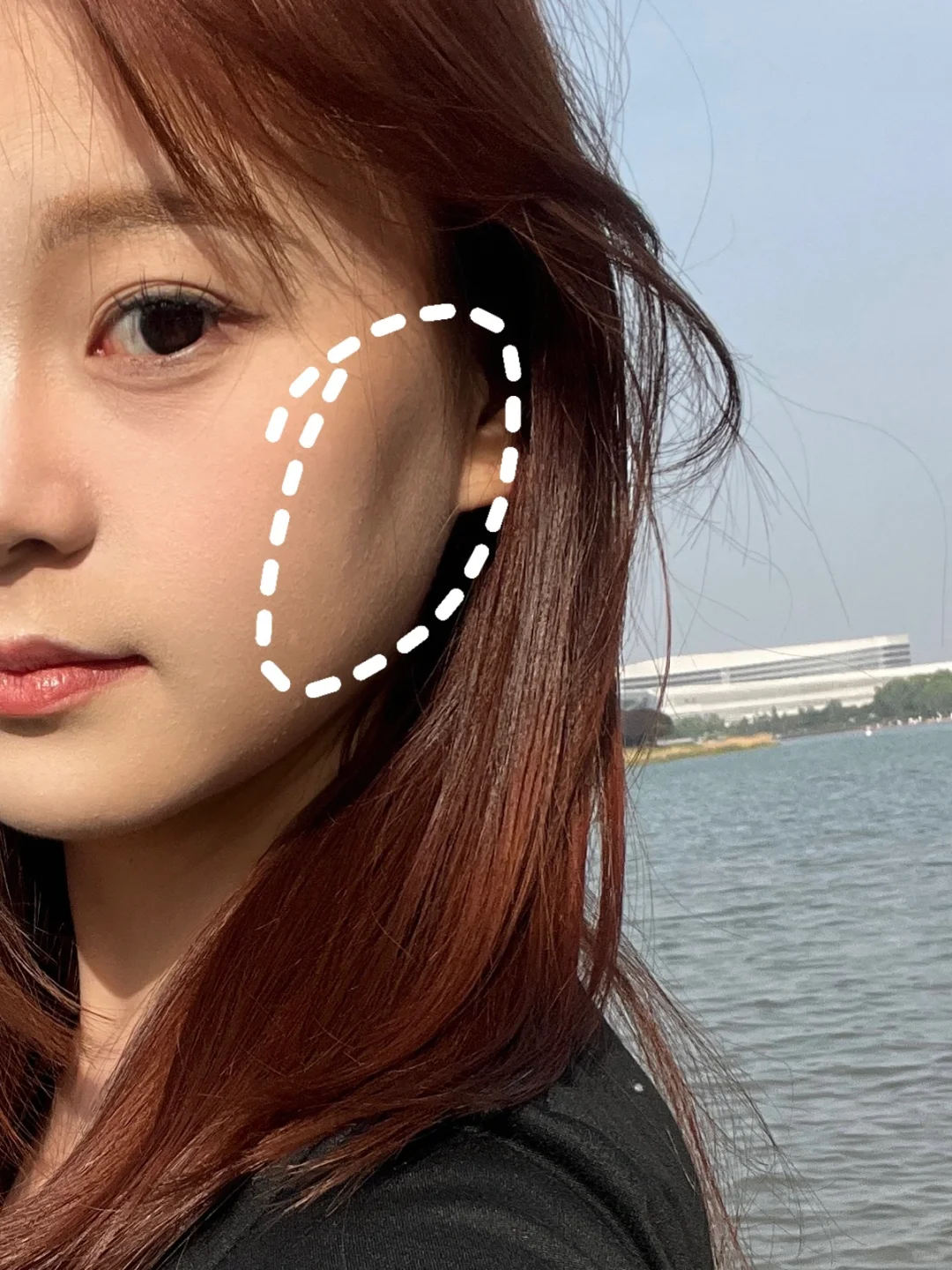 脸凹进去一块这是怎么回事