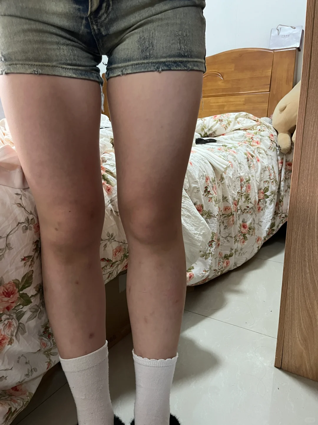 真实评价 这种腿算粗吗…