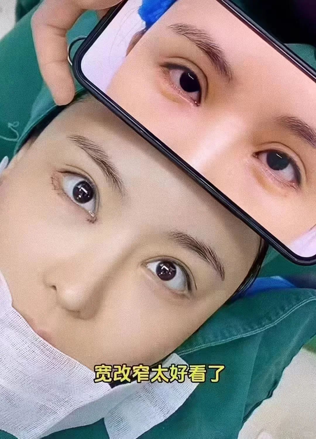 高级感的双眼皮并不是有一道褶儿就可以的