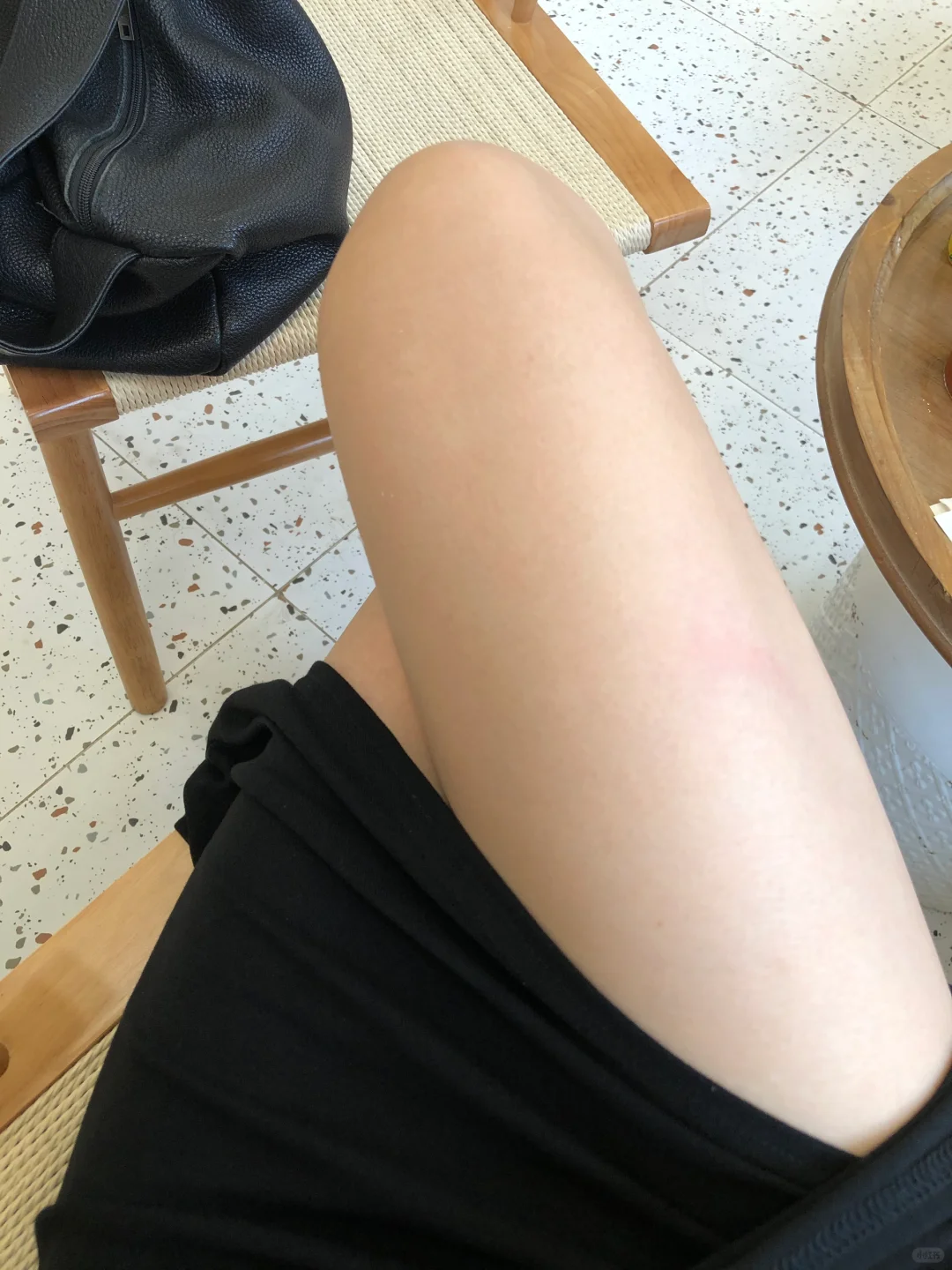 我真的不明白为什么蚊子总是咬我