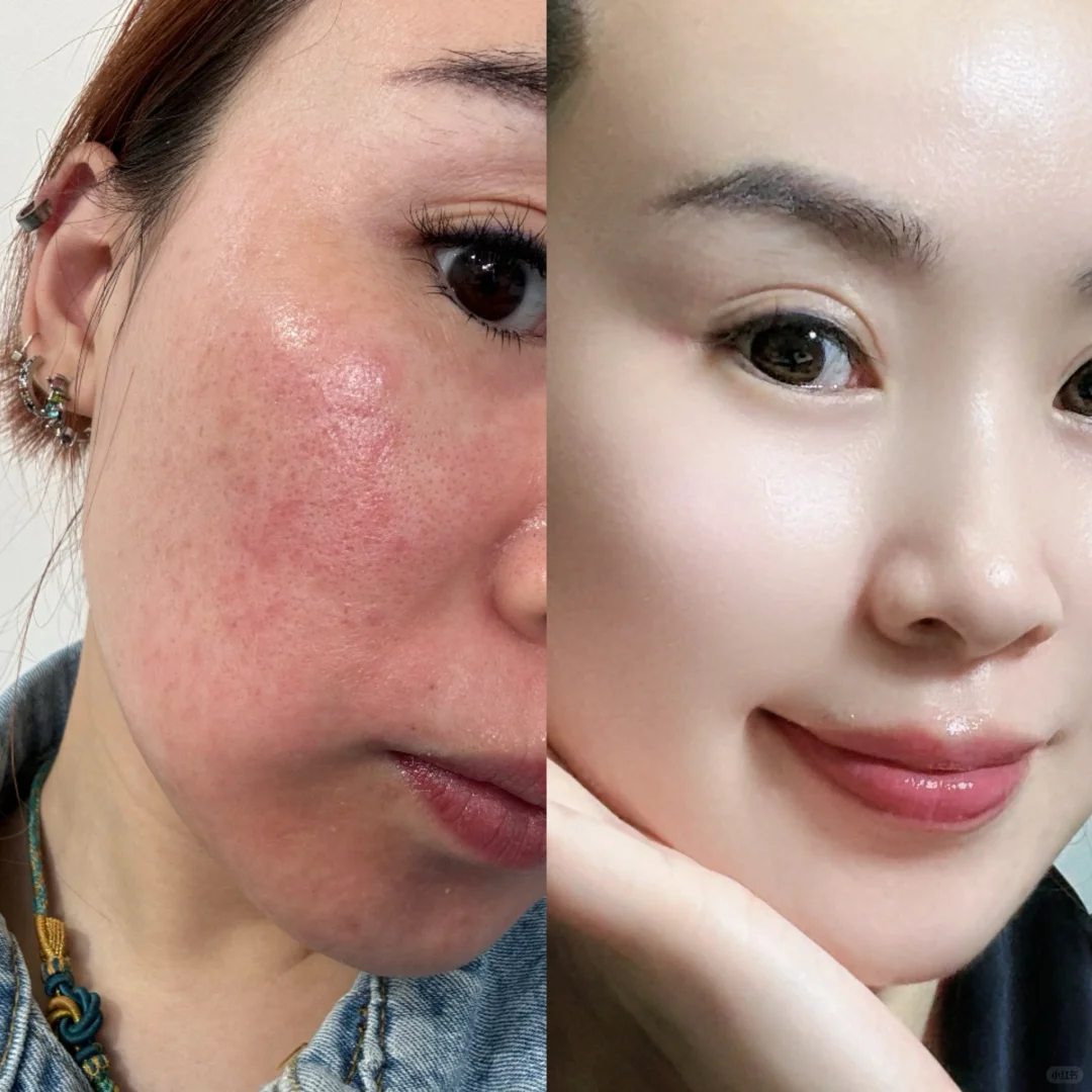 我终于熬过来了