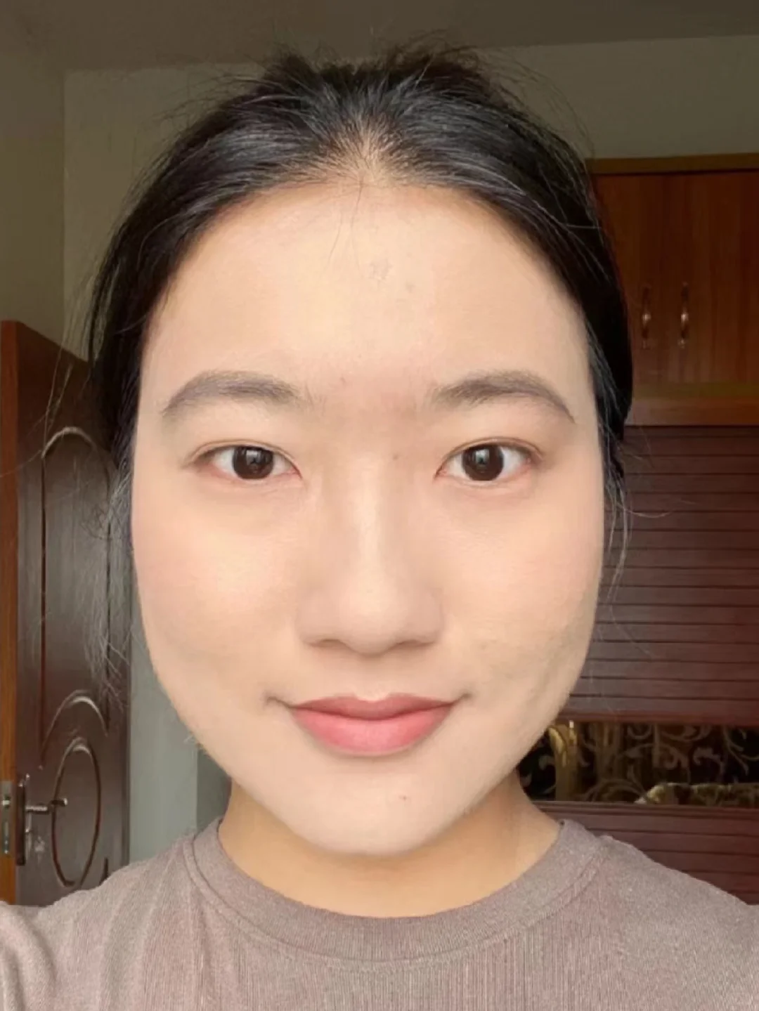 白班脸上三个月，可算甩掉了
