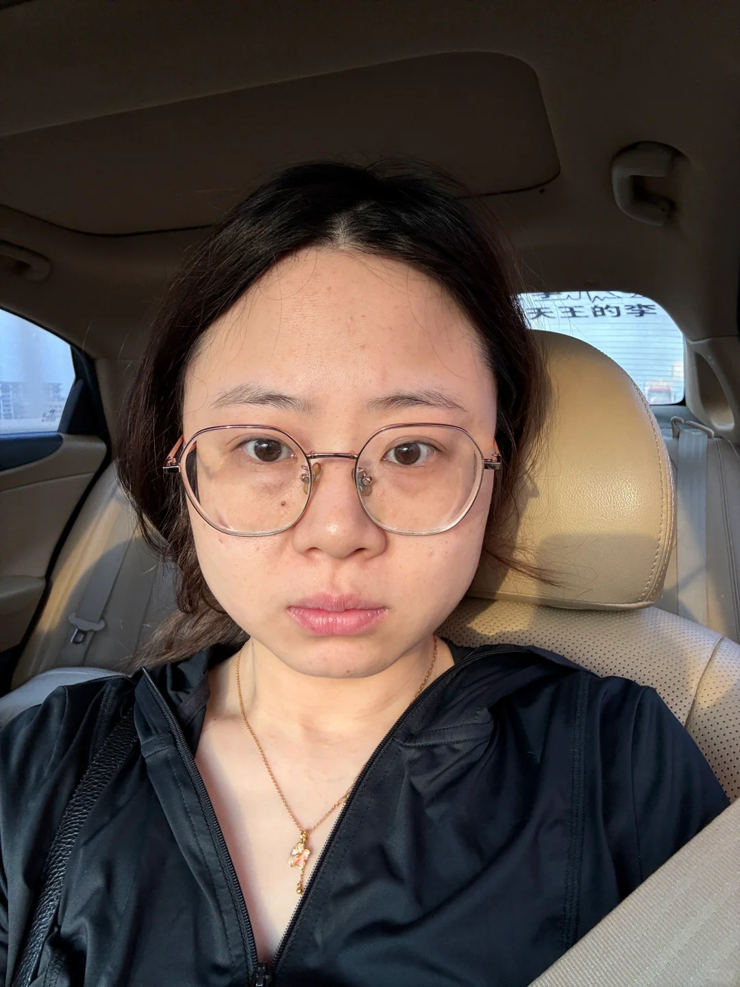 记录瘦脸💉