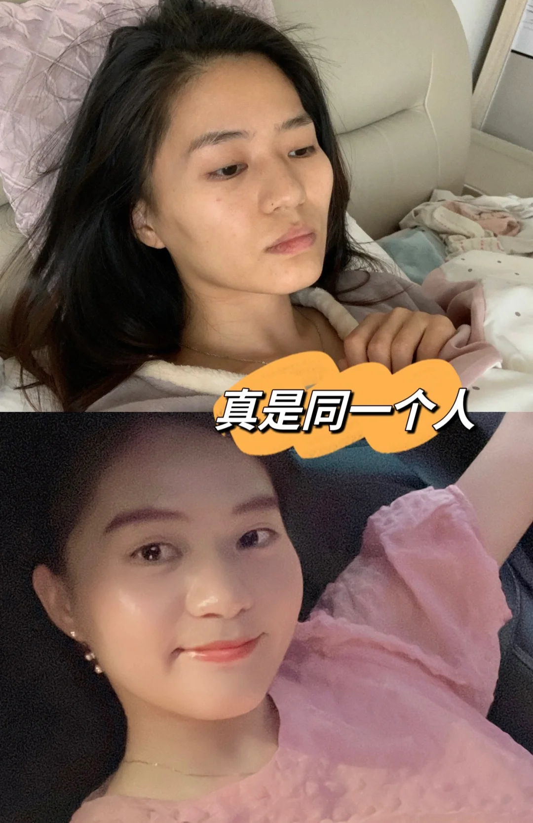 健康增重25斤❗️身材匀称真的很漂亮