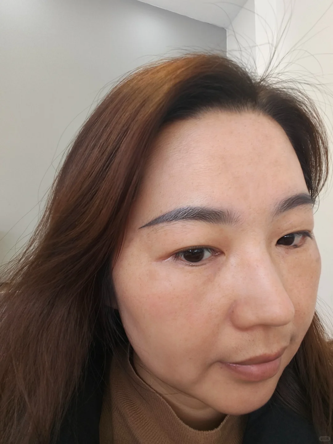 坚持姜片洗脸三个月，黄褐斑不见了