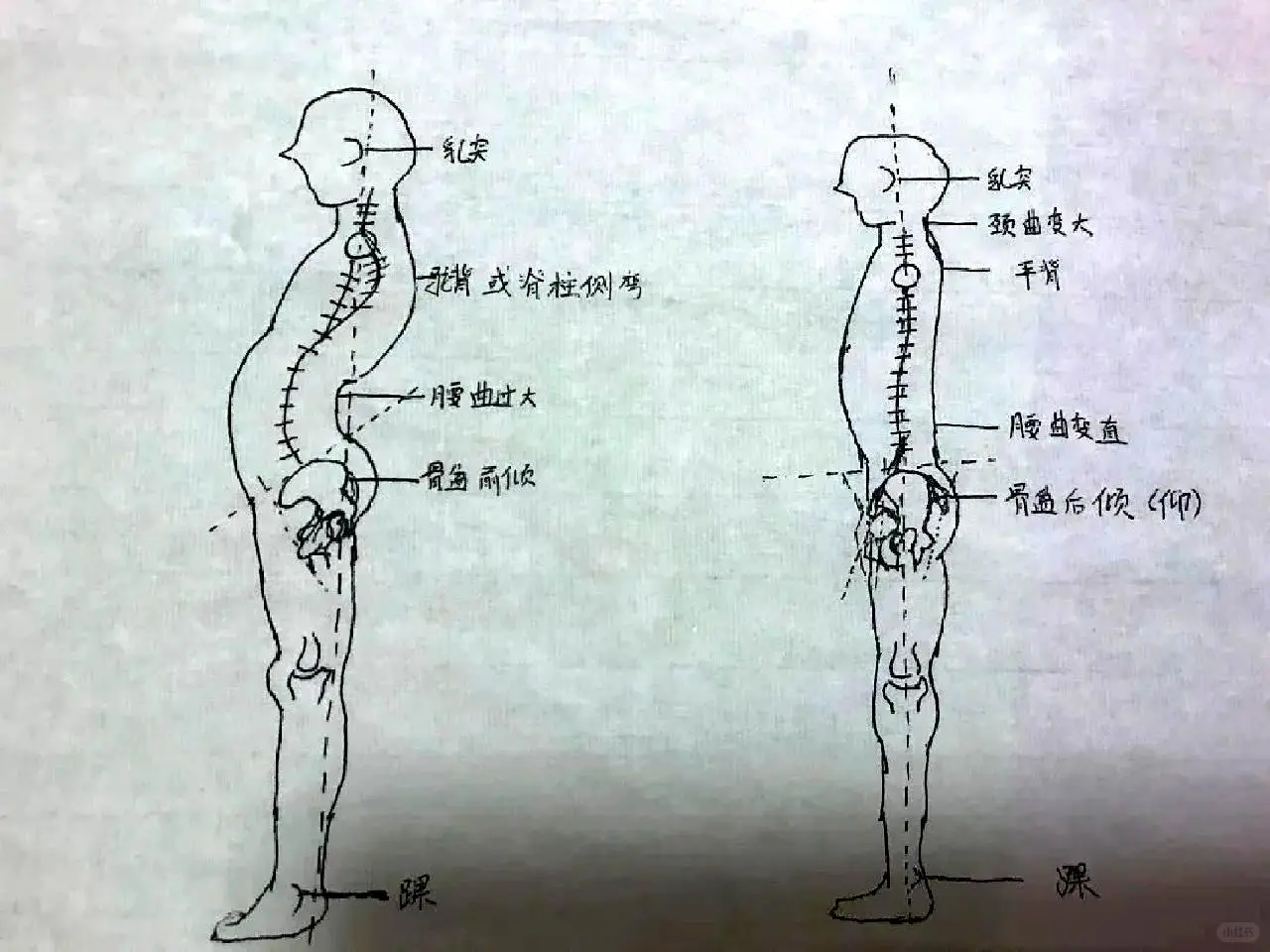 身体立线到底是什么呢？