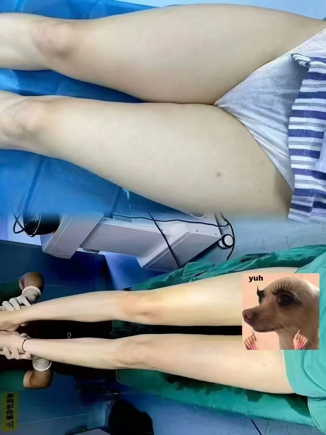 腿确实变好看了！美腿小姐姐！