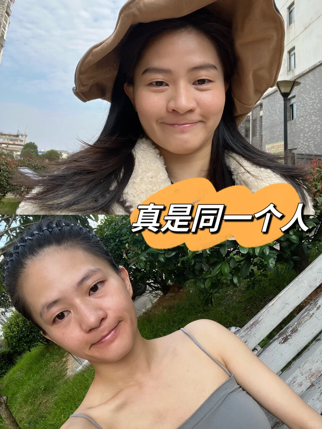 健康增重25斤❗️身材匀称真的很漂亮