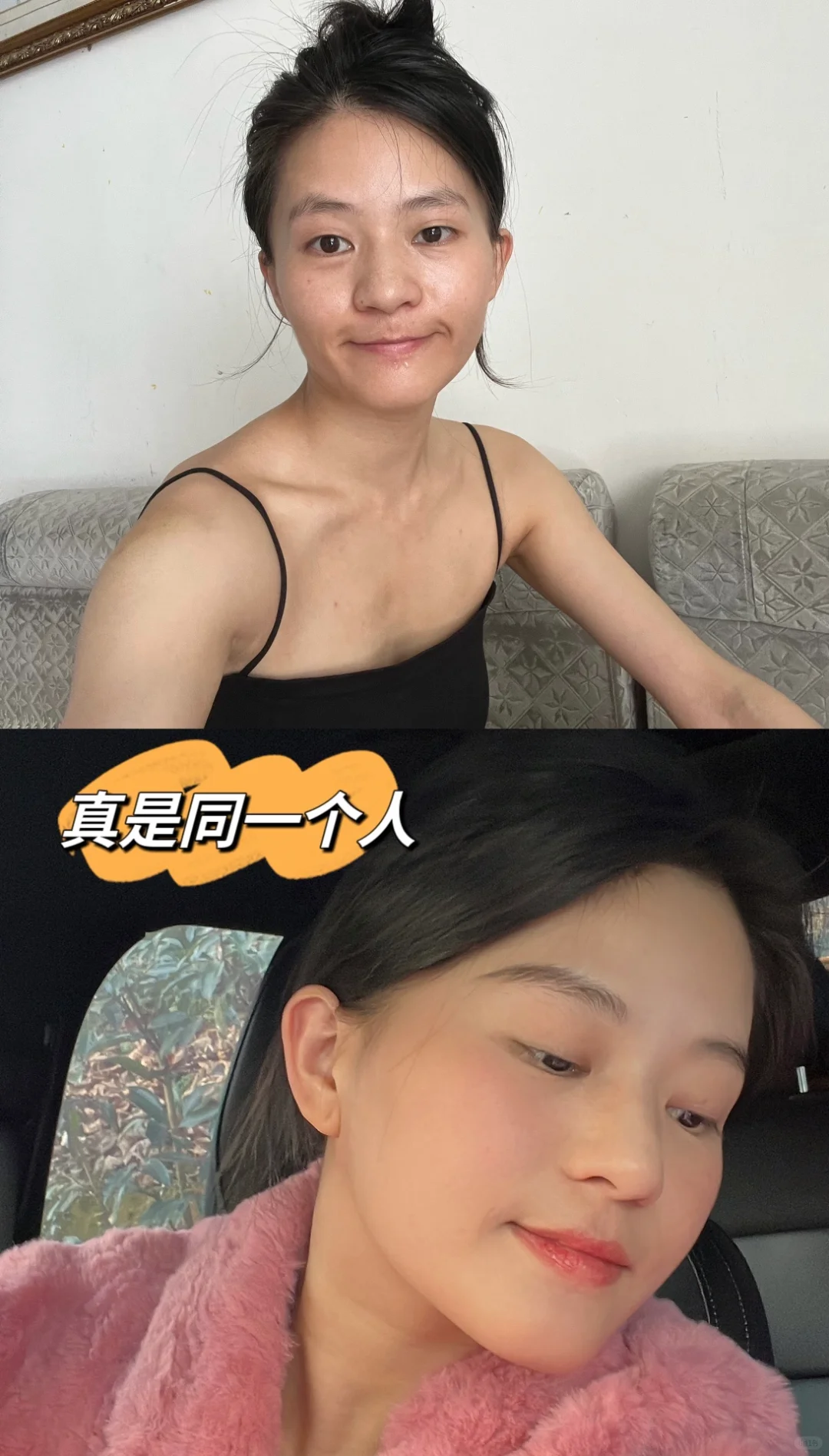 健康增重25斤❗️身材匀称真的很漂亮