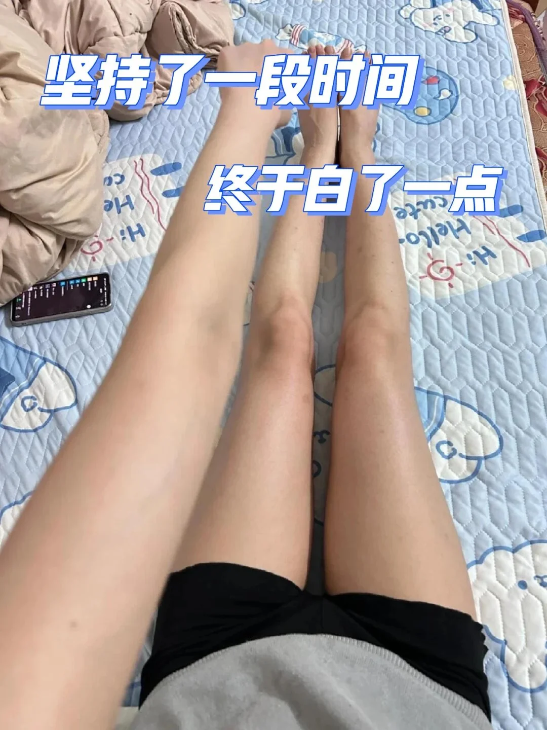 冷白皮的困扰