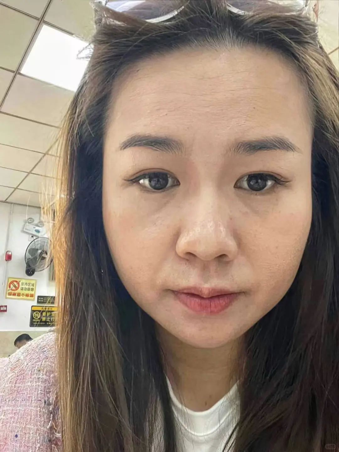 34岁脸垮成我这样怎么办呀？太焦虑了！