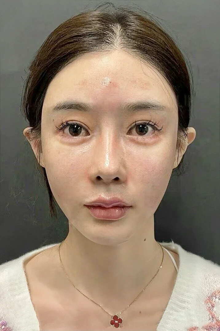 不玻璃心，两个出头，值吗？