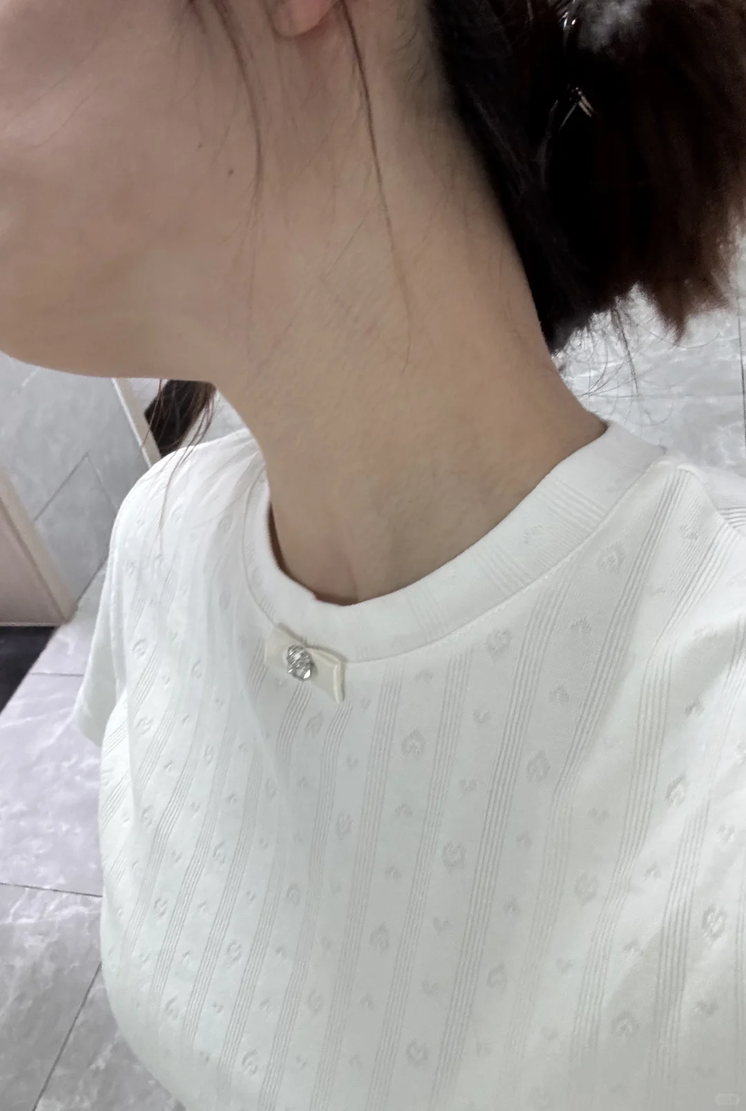 有没有宝宝看看是不是胰岛素抵抗啊啊啊