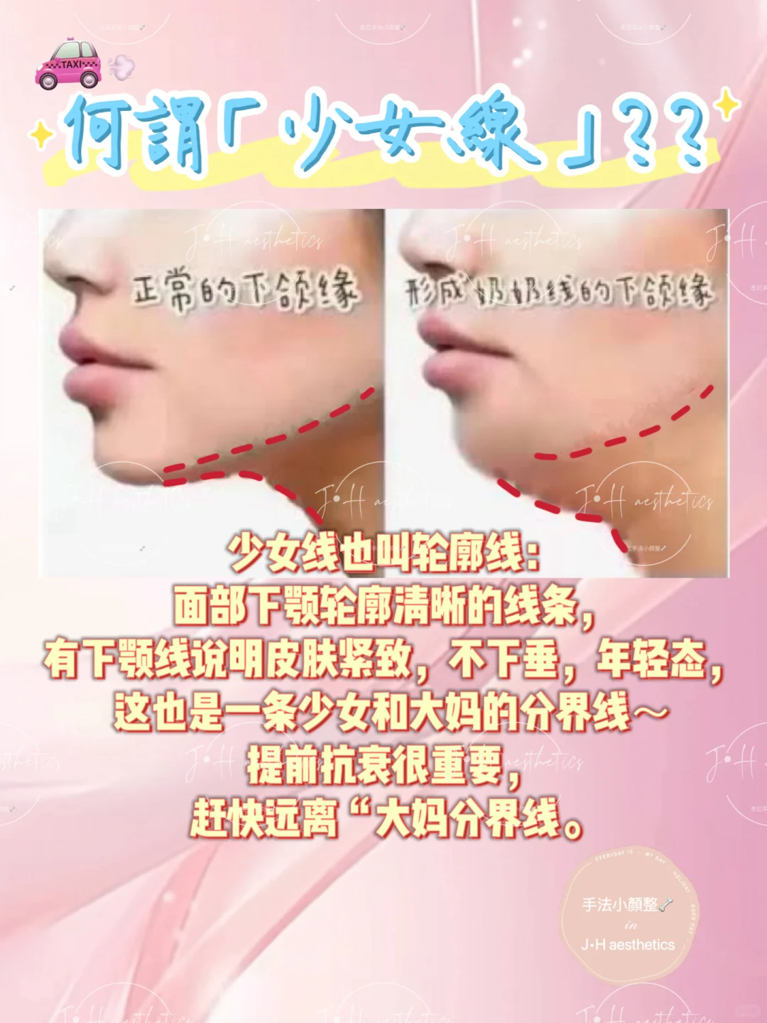 什麼是「少女線」？