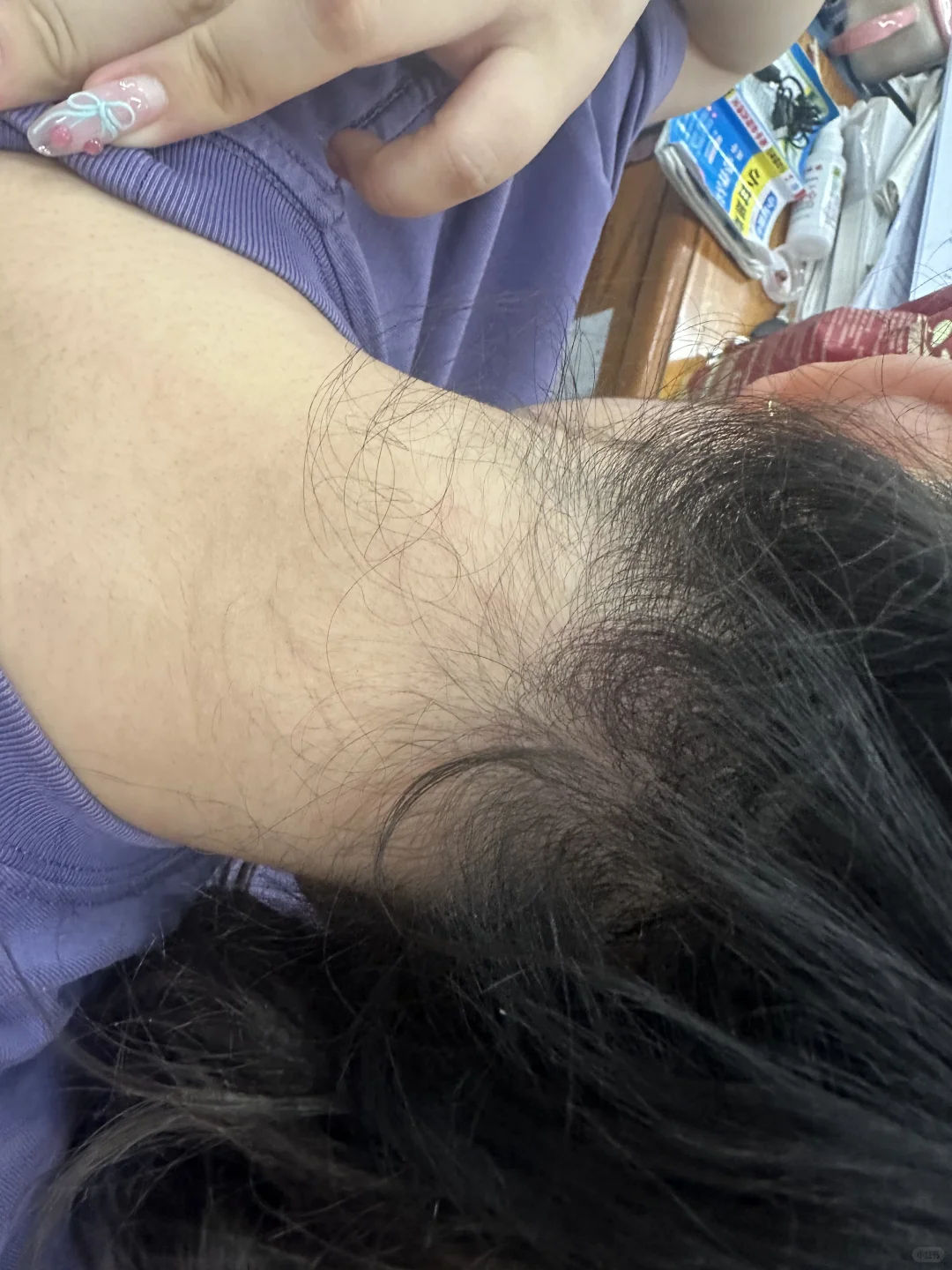 求问！我是不是胰岛素抵抗