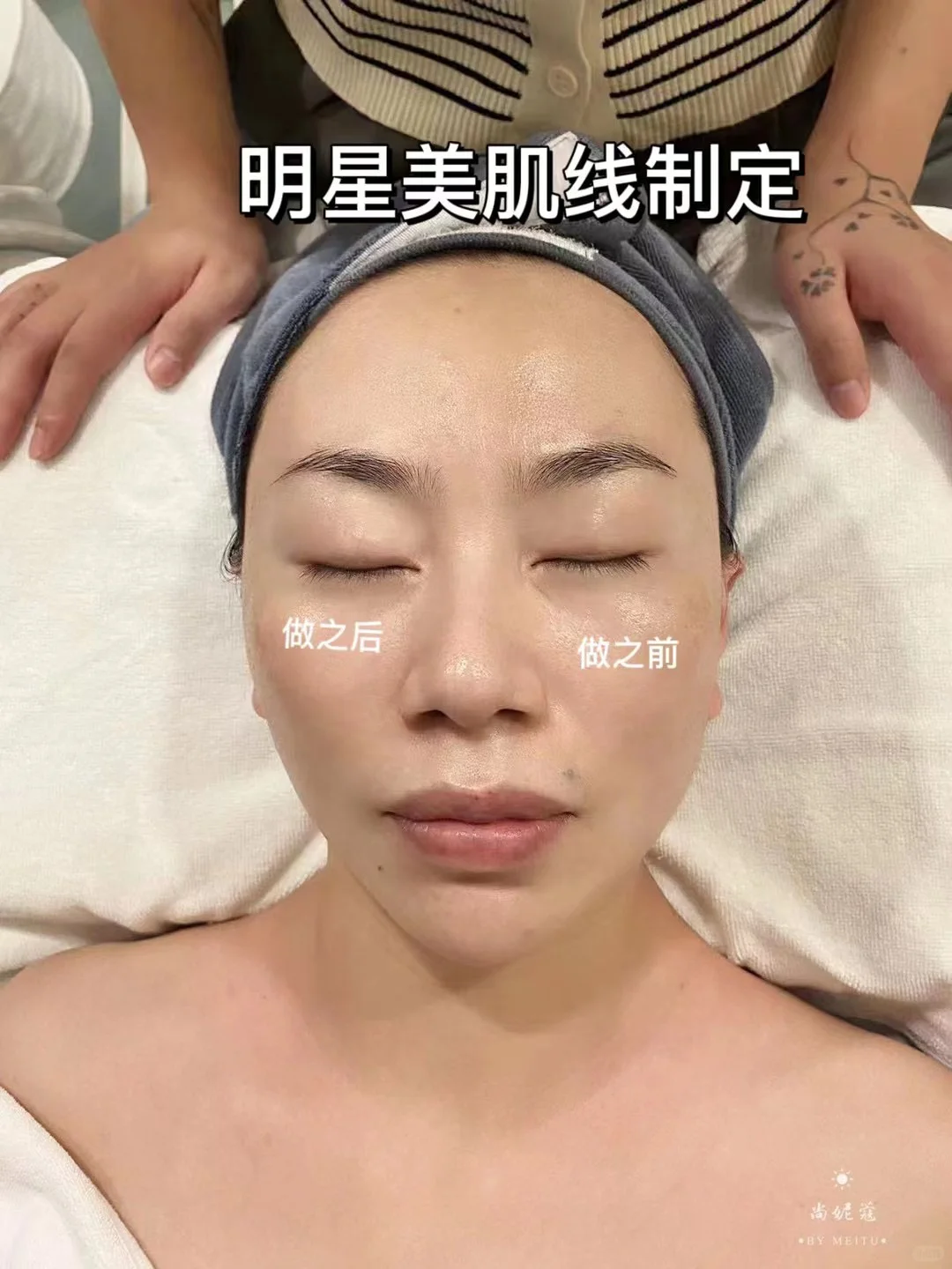 小v脸三部曲隆重推荐