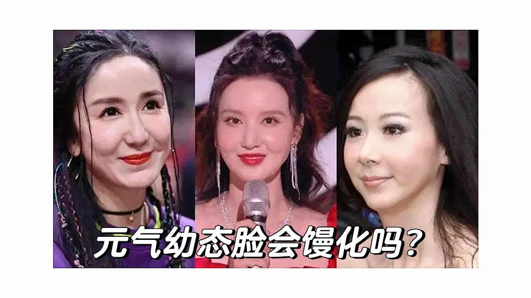 急急急 现在真的会有人还在做元气幼态脸吗？
