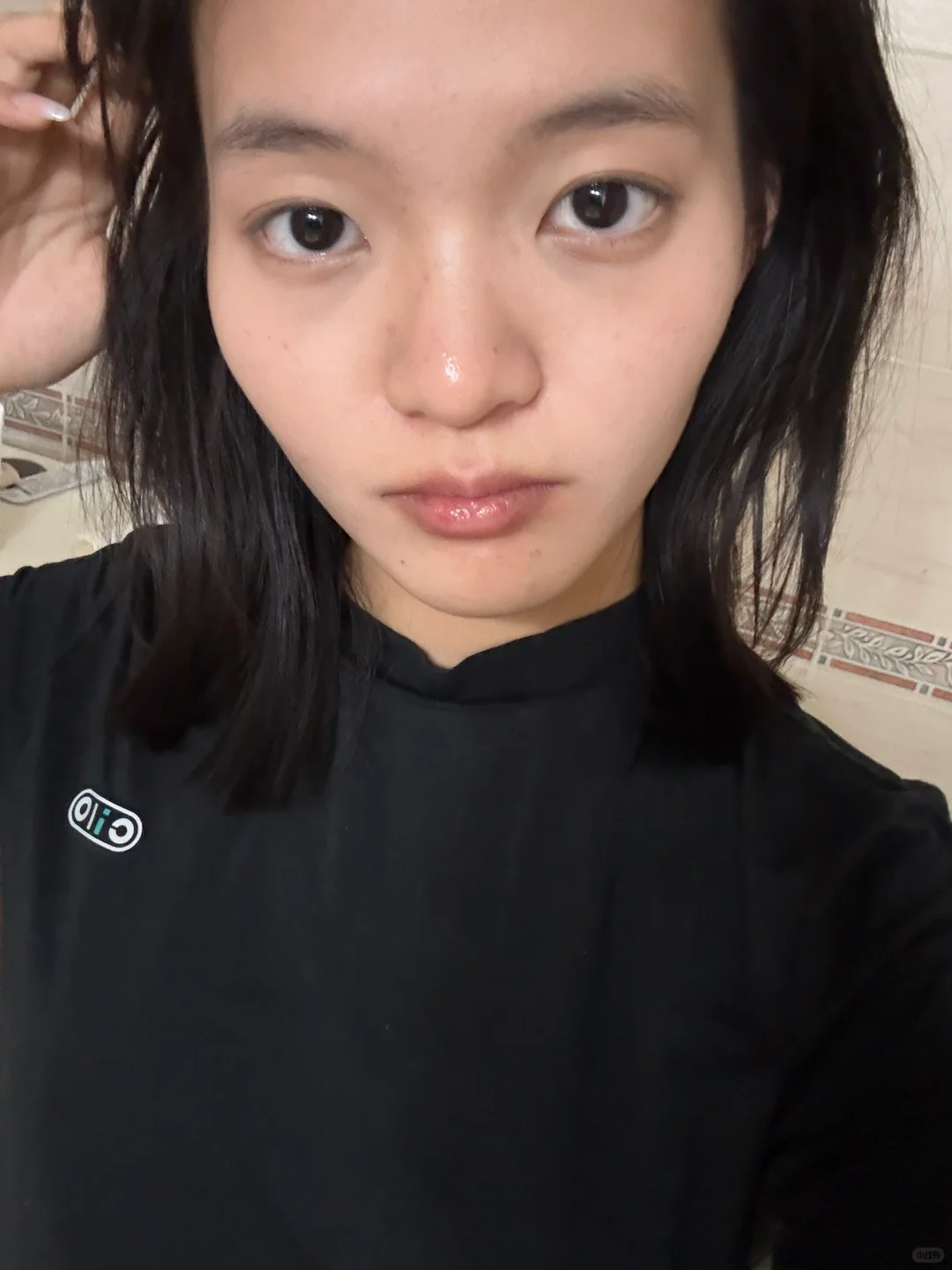 颧骨太高了咋办