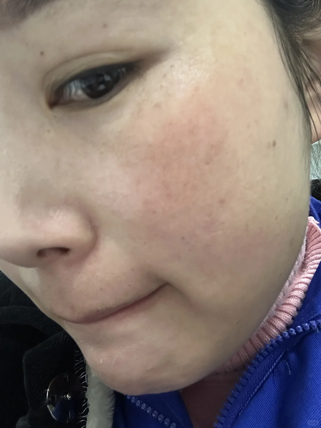 我这脸谁来拯救一下，求指点