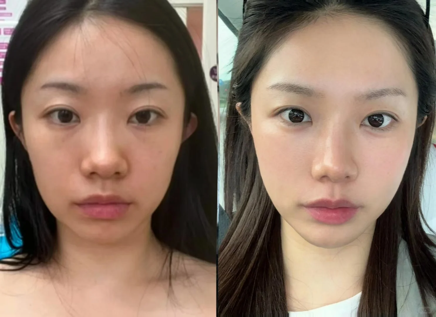我这真的是微微微嘟了吧