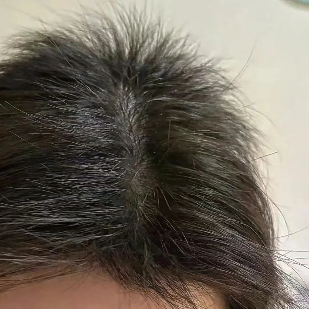 雄脱女孩，记录每天内调八个月的反馈！