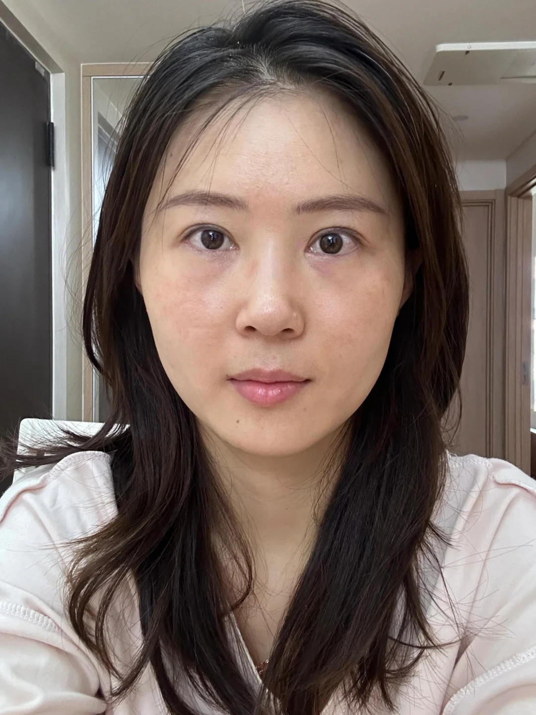 坚持打卡五个月，黄褐斑不见了