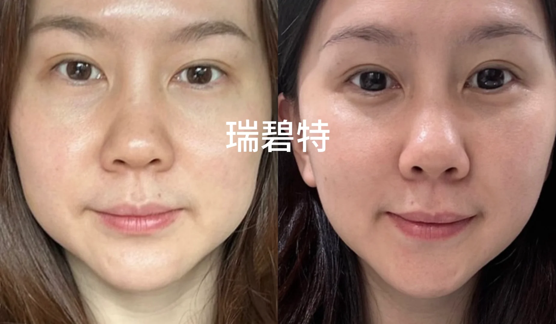 本人认为目前垮脸恢复最快的y美