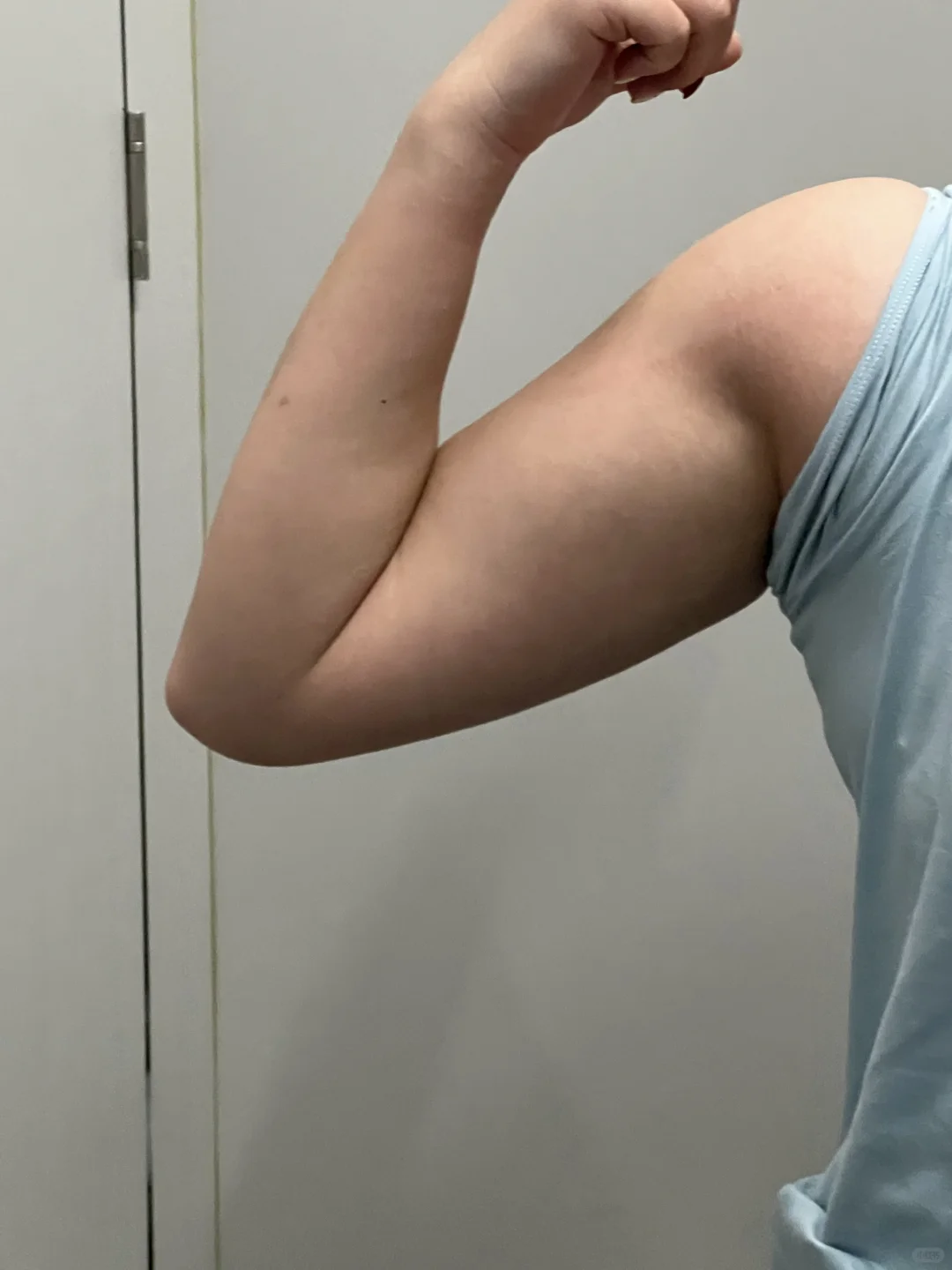 家人们 这种手臂怎么办