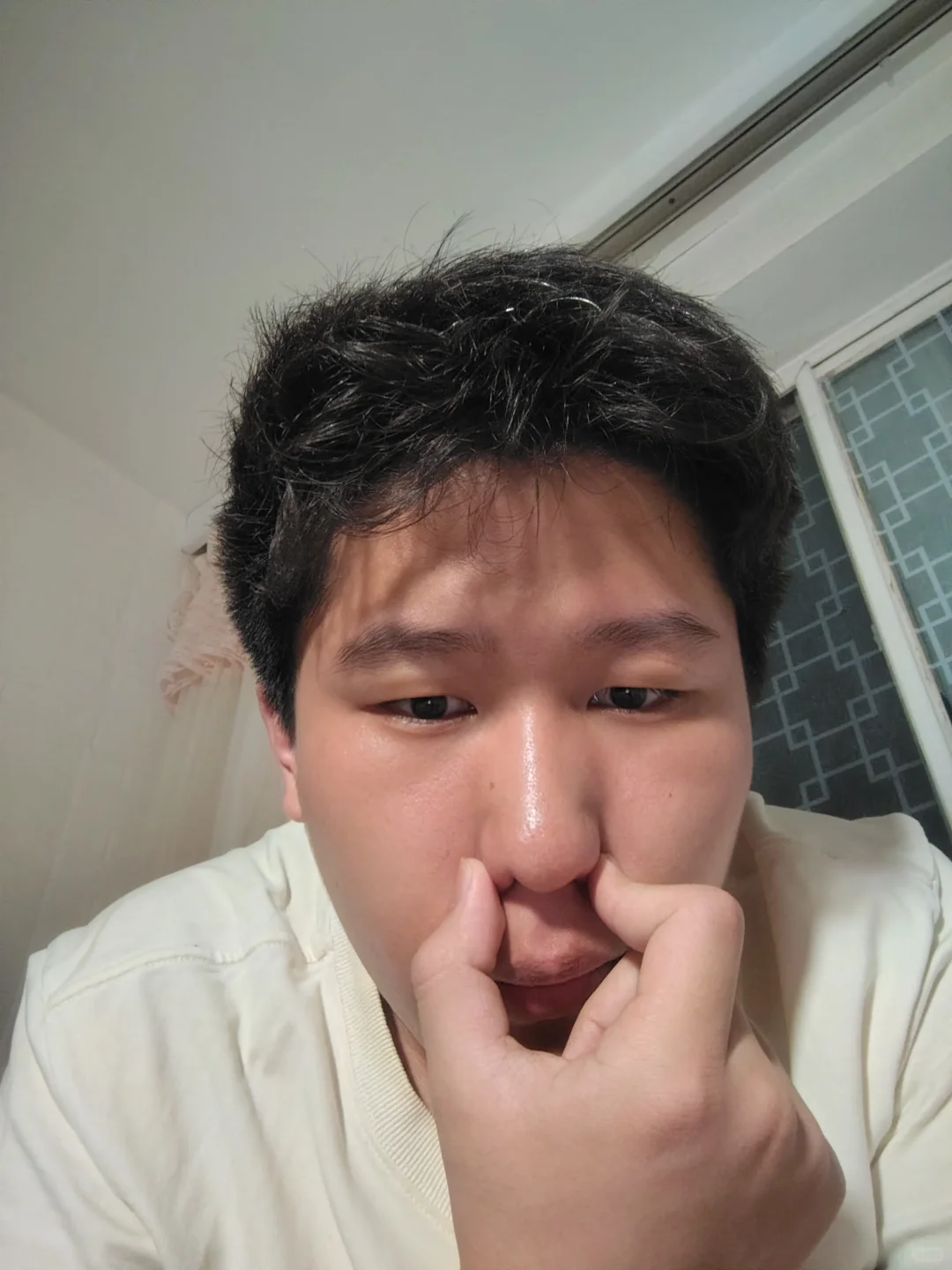 重度容貌焦虑