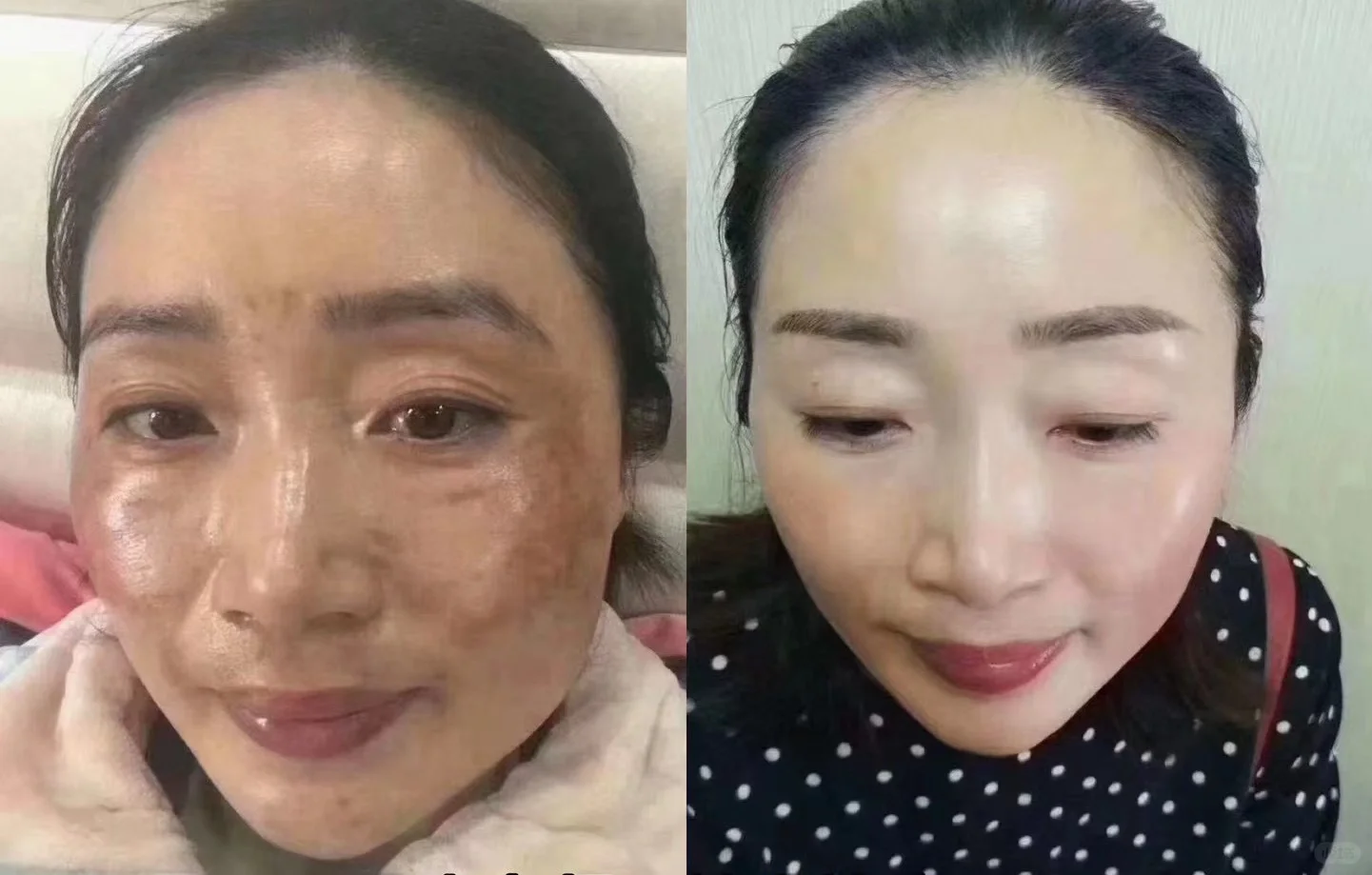 地图爬满你的脸吗？