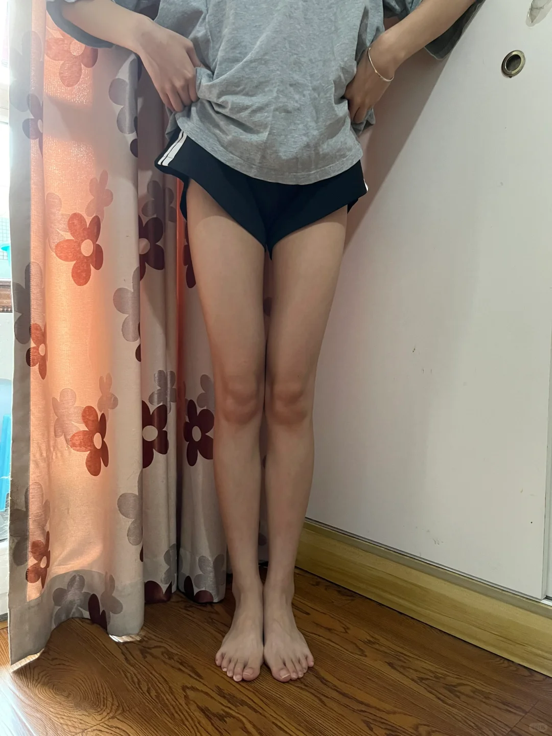 一些瘦腿后的live图｜瘦腿期间真的要注意❗️