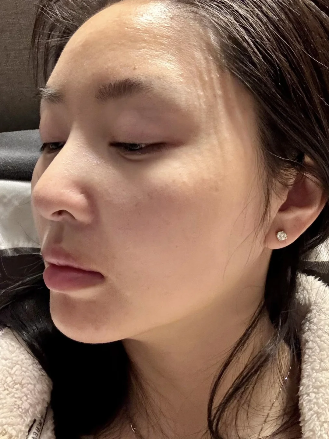 打卡六个月，黄褐斑淡没了