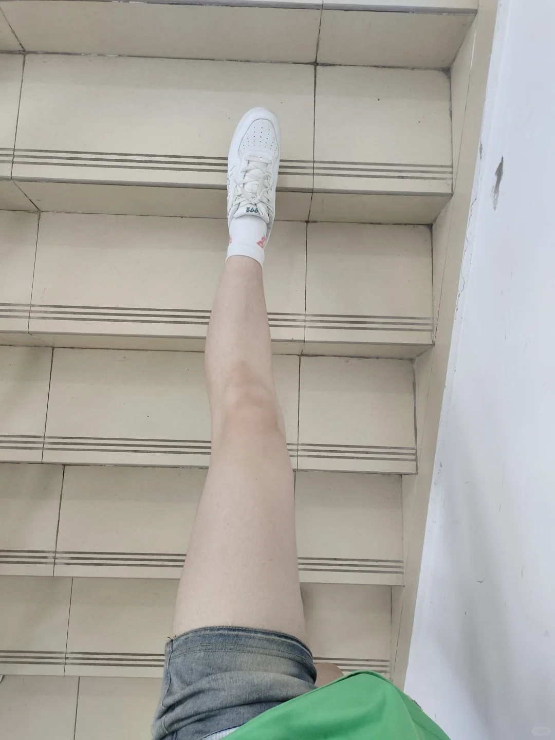 我的腿。。为什么是这样