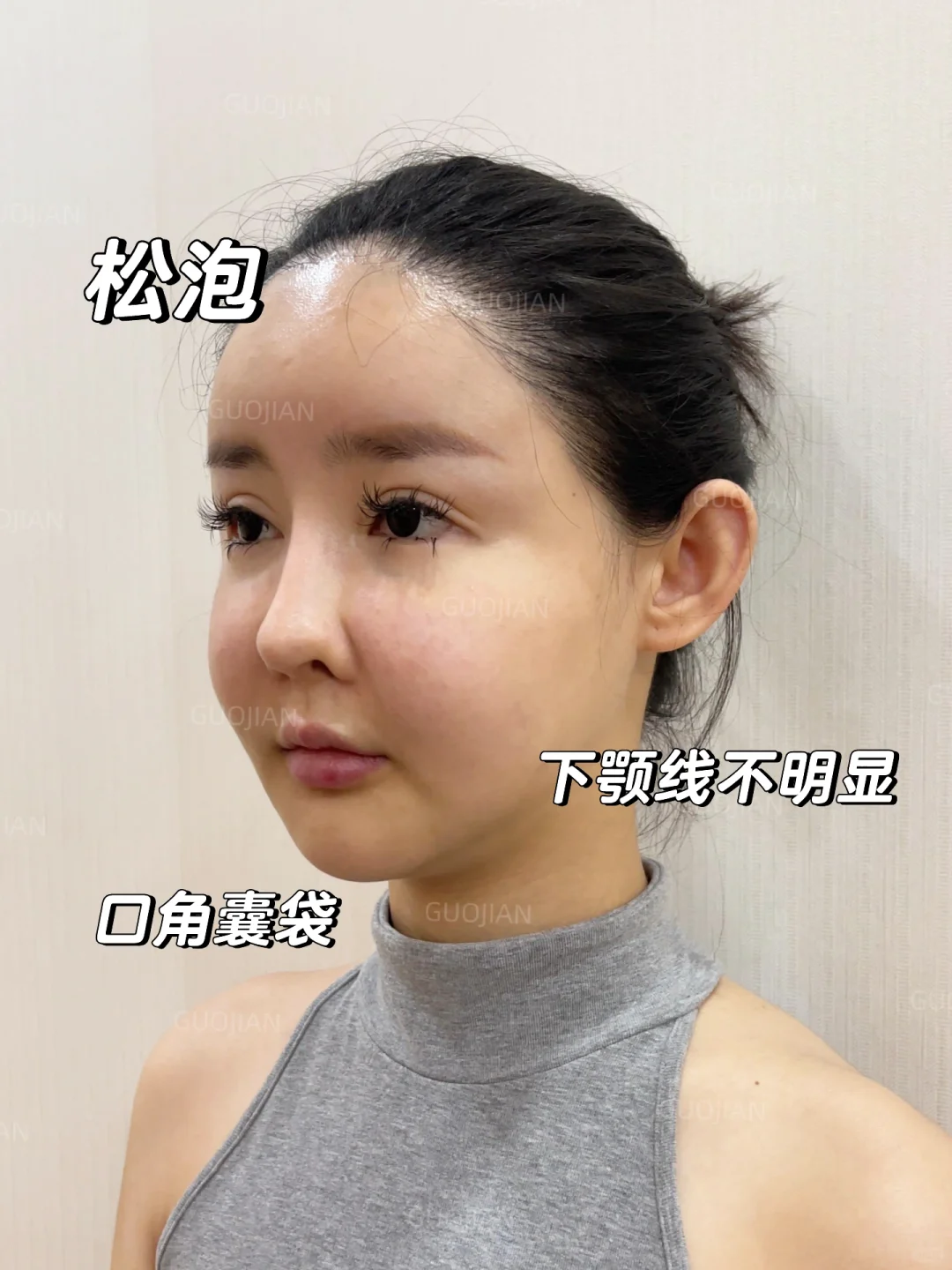 左滑看我从馒化脸变成轻薄脸皮贴骨感